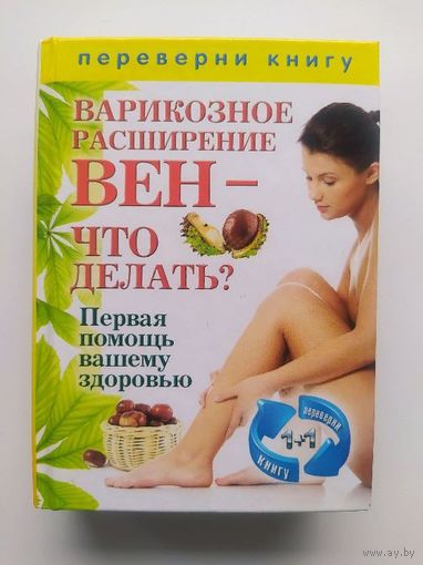 Варикозное расширение вен. Боль в суставах