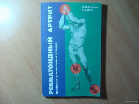Ревматоидный артрит