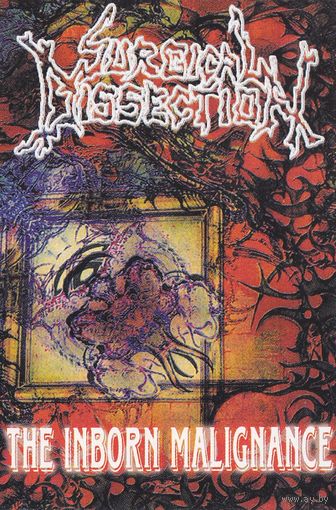 Surgical Dissection "The Inborn Malignance" кассета