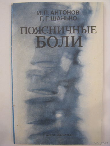Поясничные боли. И.П.Антонов, Г.Г.Шанько.